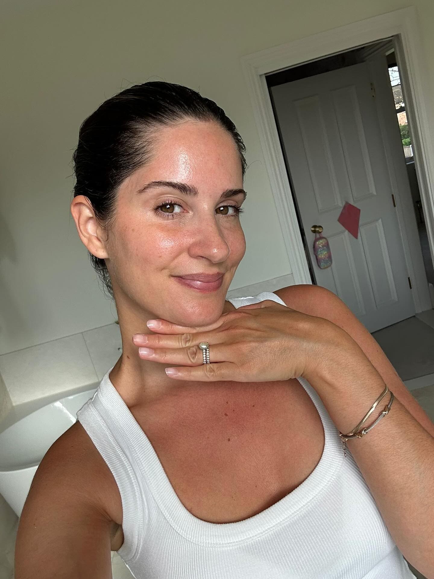 Glowing skin after Medik8 enzyme peel and microneedling treatment