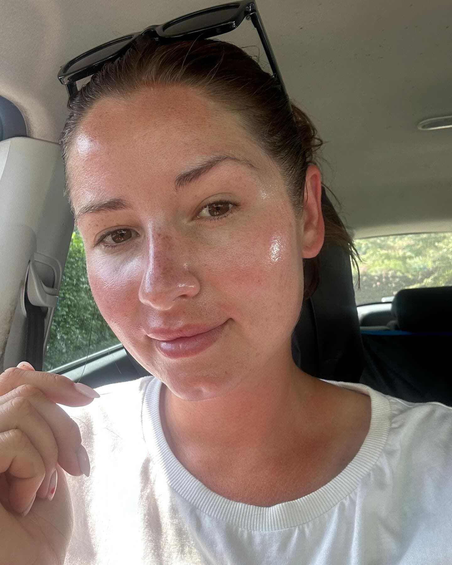 Glass look skin from meta therapy skin needling and dermaplaning